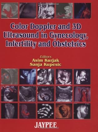 Color Doppler & 3D Ultrasound in Gynecology, Infertility & Obstetrics                                                                                 <br><span class="capt-avtor"> By:                                                  </span><br><span class="capt-pari"> Eur:40,63 Мкд:2499</span>